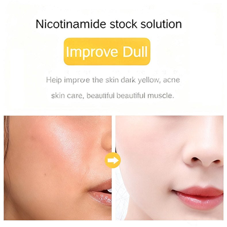 24K Gold Hyaluronic Acid Niacinamide Facial Essence | Collagen-Rich | Anti-Aging | Hydrating Whitening | Face Tightening