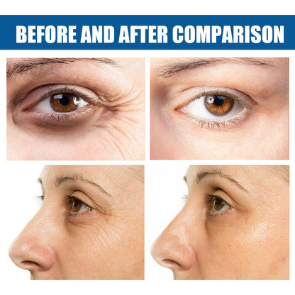 Collagen eye mask reduces fine lines and dark circles Hydrating, hydrating, firming and lifting crystal eye mask