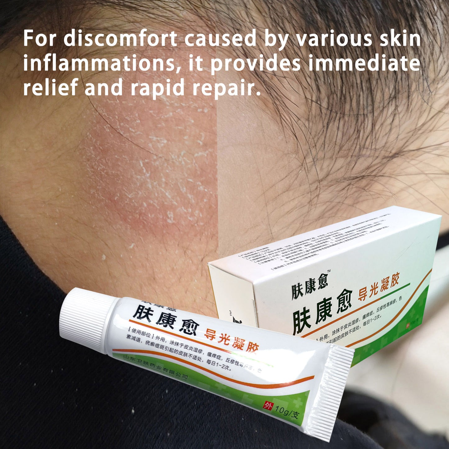 Light-Guiding Gel For Skin Disease Treatment | Targets Dermatitis | Eczema | Pruritus | Pigmentation | Acne Scars